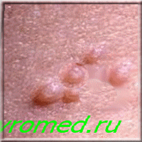  �������  - ����  