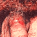  �������  ����  